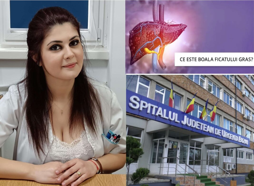Ficatul gras non-alcoolic | Interviu cu dr. Alexandra Sava, medic specialist medicină internă și șef secție în cadrul S.J.U. Buzău Ficatul gras non-alcoolic | Interviu cu dr. Alexandra Sava, medic specialist medicină internă și șef secție în cadrul S.J.U. Buzău