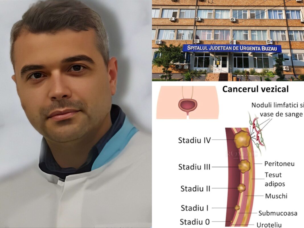 Cancerul de vezică urinară | Interviu dr. Niță Marius, medic primar urolog în cadrul S.J.U. Buzău Cancerul de vezică urinară | Interviu dr. Niță Marius, medic primar urolog în cadrul S.J.U. Buzău