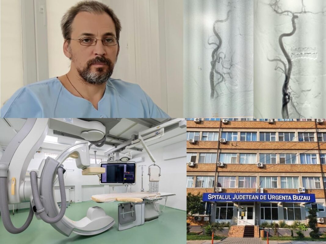 Premieră la Spitalul Județean de Urgență Buzău: angioplastie carotidiană cu stent cu plasă antiembolică Premieră la Spitalul Județean de Urgență Buzău: angioplastie carotidiană cu stent cu plasă antiembolică