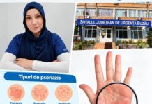 Psoriazisul și impactul asupra calității vieții. Sfaturile medicului specialist