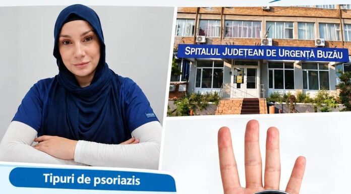 Psoriazisul și impactul asupra calității vieții. Sfaturile medicului specialist